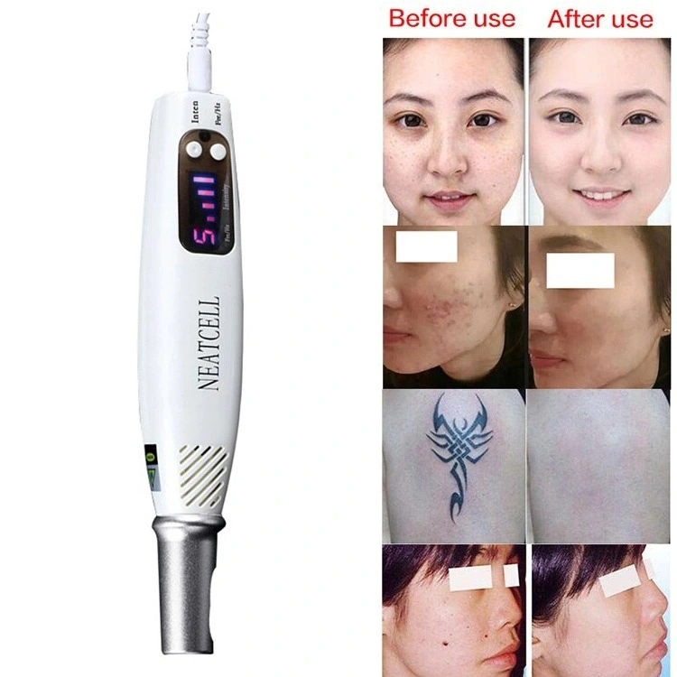 Home Use Picosecond Laser Pen for Tattoo Removal Sun Spot Removal Mole Removal