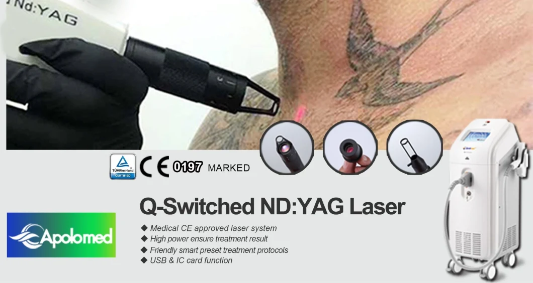 Q Switch Tattoo Removal ND YAG Laser and Also for Mole Removal